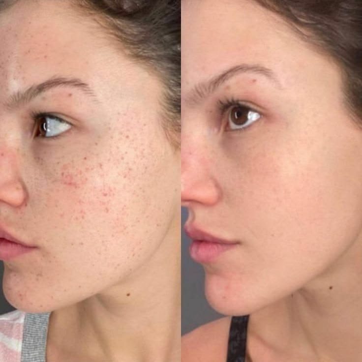 Before and after showing marks fading