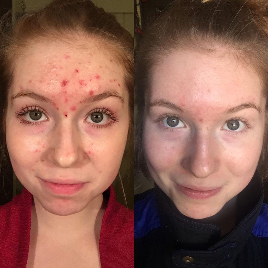 Before and after across the whole face