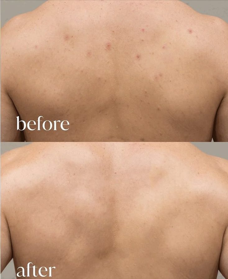 Rania F. before and after